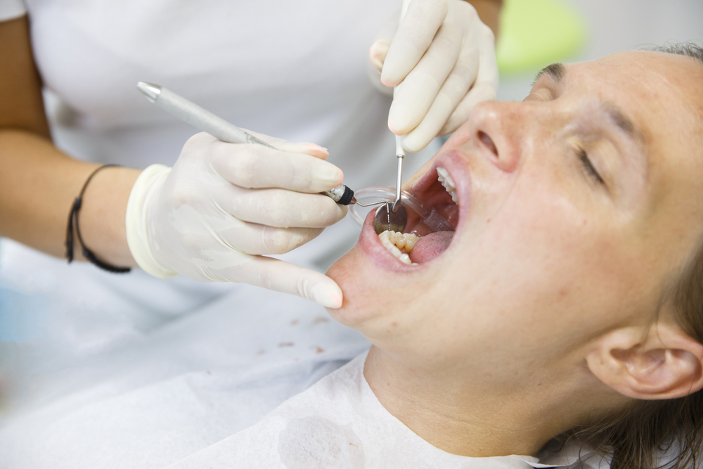 3 Warning Signs That You Might Need a Root Canal