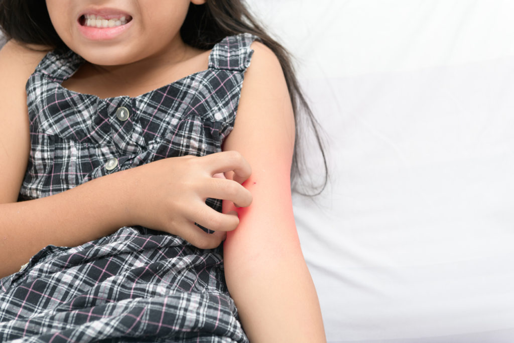 little girl scratching her arm