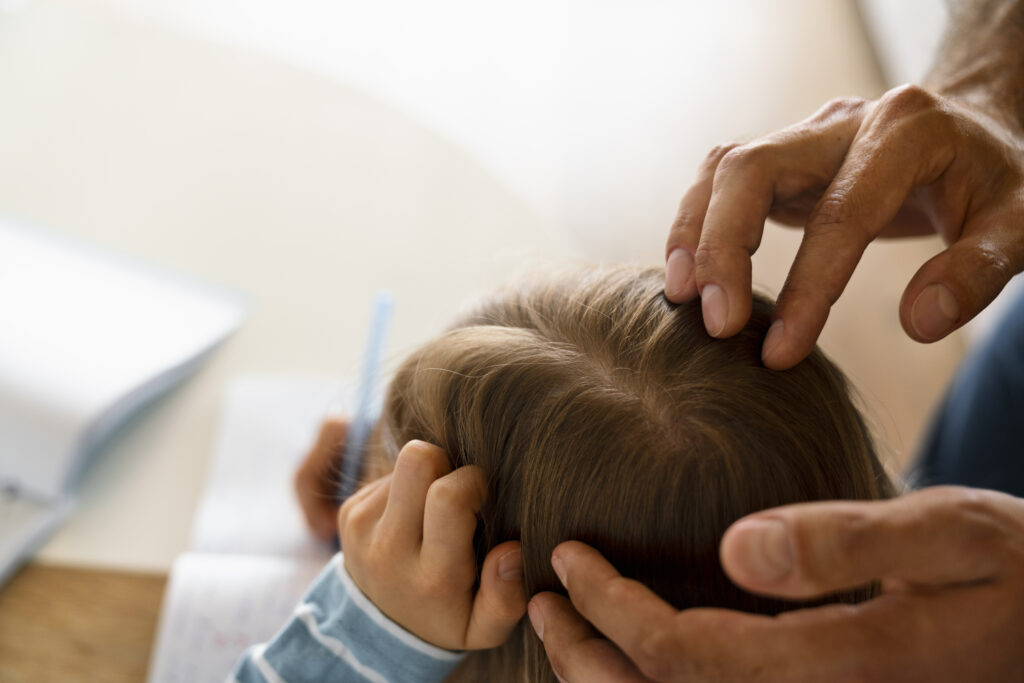 From Mercury to Mayo: How the War Against Head Lice Has Changed Through the Years